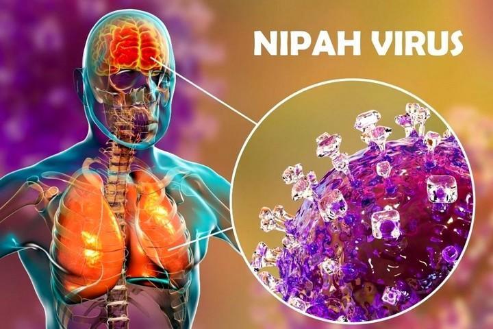 Virus Nipah Yang Belum Ditemukan Vaksinnya